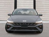 2026 Hyundai Elantra Preferred w/Tech Pkg image 2