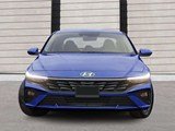 2025 Hyundai Elantra Preferred w/Tech Pkg image 2