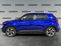 2022 Hyundai Venue Ultimate IVT w/Black Interior